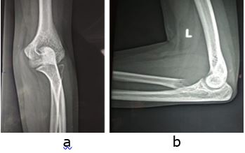 ojmpc_103_02.jpg