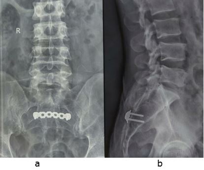 ojmpc_104_04.jpg
