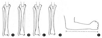 ojmpc_111_00.jpg