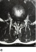 ojmpc_113_01e.jpg