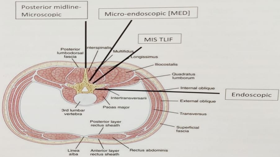 ojmpc_129_01.jpg