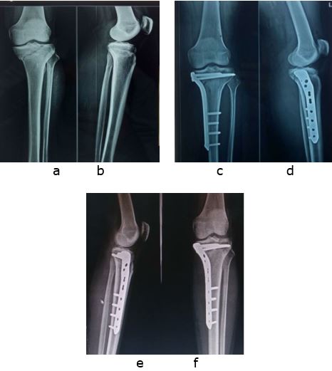 ojmpc_136_02.JPG