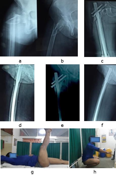 ojmpc_139_01.JPG