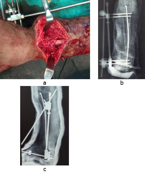ojmpc_144_04.JPG