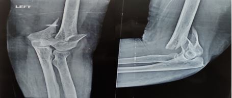 ojmpc_153_04.jpg