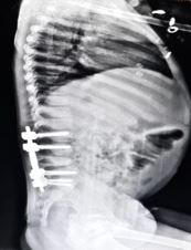 ojmpc_155_07.jpg