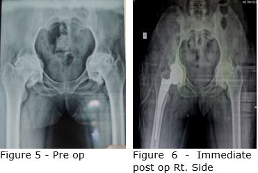 ojmpc_160_05.jpg