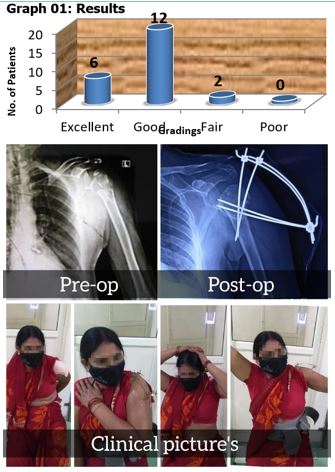 ojmpc_161_01.jpg