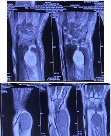 ojmpc_165_06.jpg