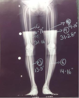 ojmpc_170_02.JPG