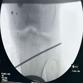 ojmpc_170_03.JPG