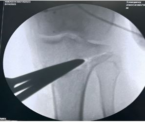 ojmpc_170_04.JPG