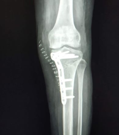 ojmpc_170_09.JPG