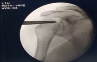 ojmpc_171_01.JPG