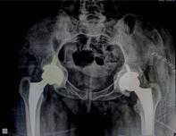 ojmpc_182_05.JPG