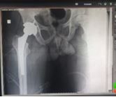 ojmpc_182_07.JPG