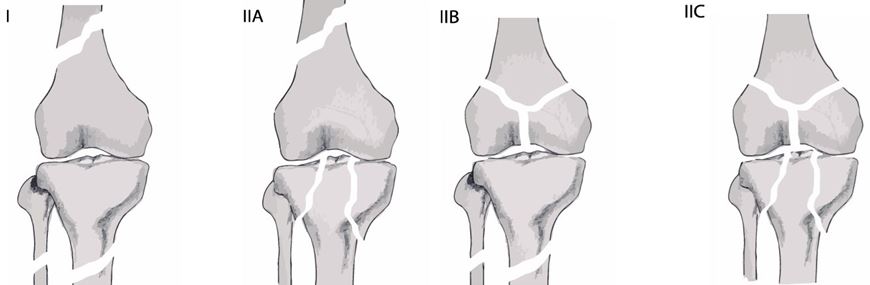 ojmpc_185_01.JPG