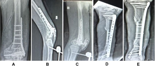 ojmpc_185_11.jpg
