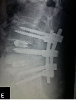 ojmpc_52_05.jpg