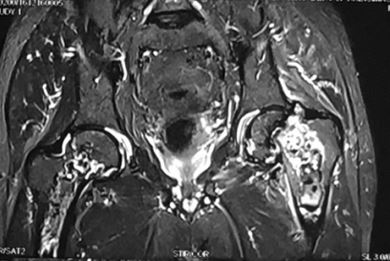 ojmpc_59_03.jpg
