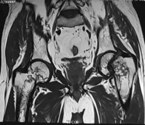 ojmpc_59_05.jpg