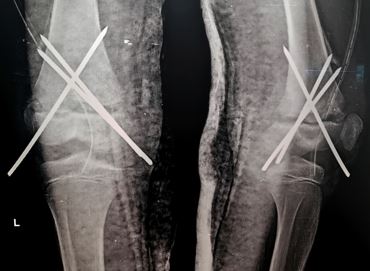 ojmpc_67_02.jpg