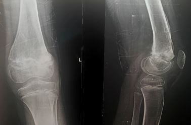 ojmpc_67_03.jpg