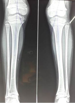 ojmpc_74_01.jpg