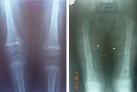 ojmpc_77_02.jpg