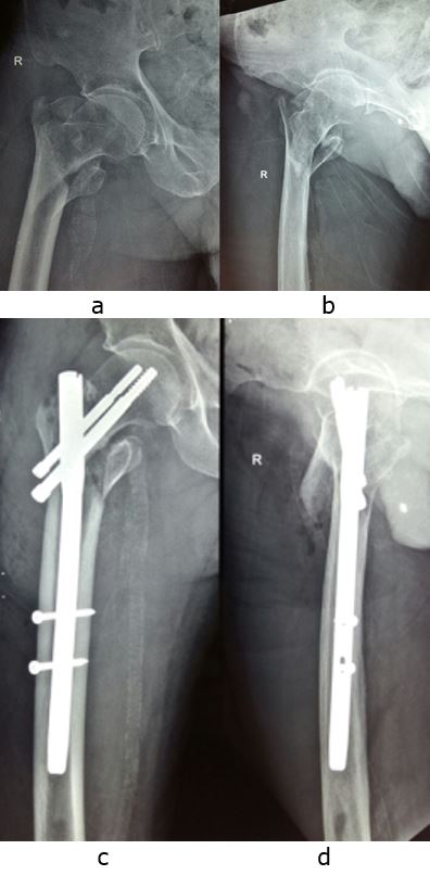 ojmpc_99_01.jpg
